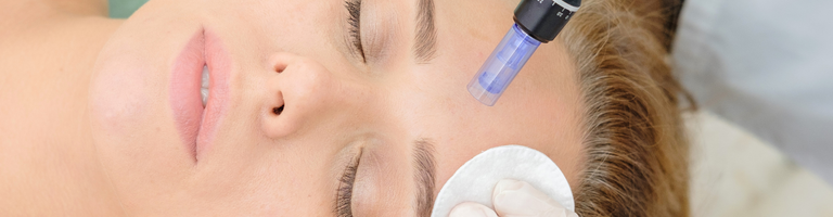 Microneedling